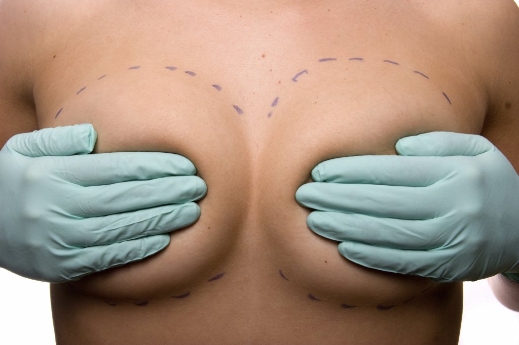 Breast Implant Options Scottsdale Breast Augmentation